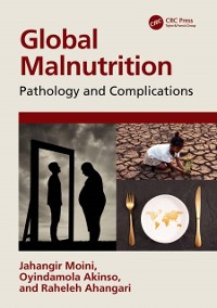 Cover Global Malnutrition