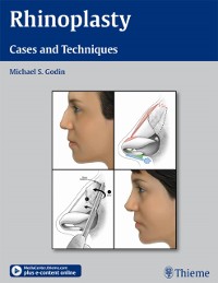 Cover Rhinoplasty