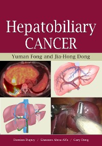 Cover Hepatobiliary Cancer