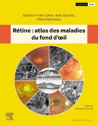 Cover Retine : atlas des maladies du fond d'oeil