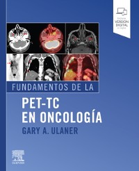 Cover Fundamentos de la PET-TC en oncología