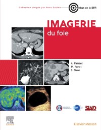 Cover Imagerie du foie