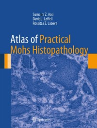 Cover Atlas of Practical Mohs Histopathology