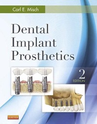 Cover Dental Implant Prosthetics - E-Book