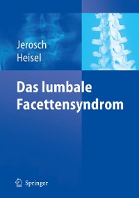 Cover Das lumbale Facettensyndrom