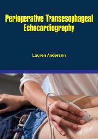 Cover Perioperative Transesophageal Echocardiography