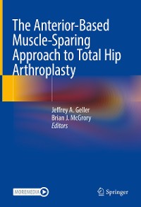 Cover The Anterior-Based Muscle-Sparing Approach to Total Hip Arthroplasty