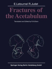 Cover Fractures of the Acetabulum