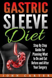 Cover Gastric Sleeve Diet