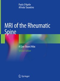 Cover MRI of the Rheumatic Spine