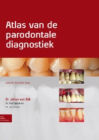 Cover Atlas van de parodontale diagnostiek