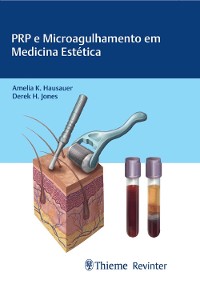 Cover PRP e Microagulhamento em Medicina Estética