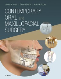 Cover Contemporary Oral and Maxillofacial Surgery E-Book