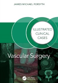 Cover Vascular Surgery: