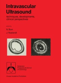 Cover Intravascular ultrasound