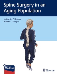Cover Spine Surgery in an Aging Population