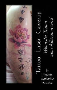 Cover Tattoo - Laser - Cover Up