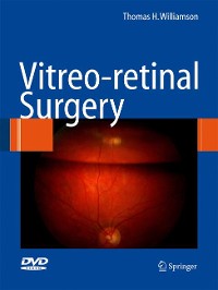 Cover Vitreoretinal Surgery
