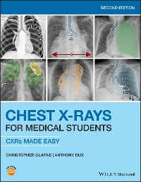 Cover Chest X-Rays for Medical Students