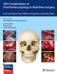 Cover 100 Complications of Otorhinolaryngology & Skull Base Surgery