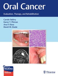Cover Oral Cancer