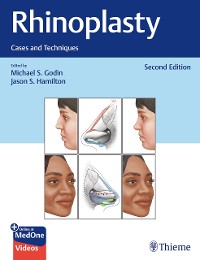 Cover Rhinoplasty