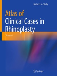 Cover Atlas of Clinical Cases in Rhinoplasty