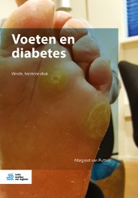 Cover Voeten en diabetes