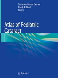 Cover Atlas of Pediatric Cataract