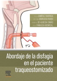 Cover Abordaje de la disfagia en el paciente traqueostomizado