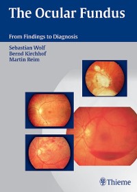 Cover The Ocular Fundus