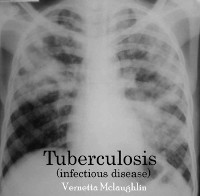 Cover Tuberculosis(infectious disease)