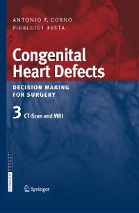 Cover Congenital Heart Defects. Decision Making for Surgery