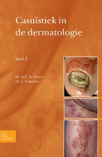 Cover Casuïstiek in de dermatologie - deel I