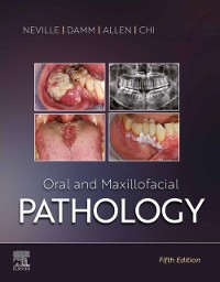 Cover Oral and Maxillofacial Pathology - E-Book