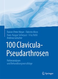 Cover 100 Clavicula-Pseudarthrosen