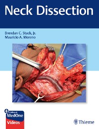 Cover Neck Dissection