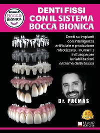 Cover Denti Fissi Con Il Sistema Bocca Bionica