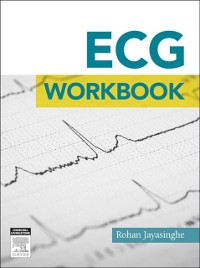 Cover ECG workbook - E-Book