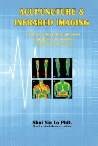 Cover Acupuncture and Infrared Imaging