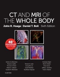 Cover Computed Tomography & Magnetic Resonance Imaging Of The Whole Body E-Book