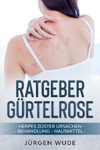 Cover Ratgeber Gürtelrose