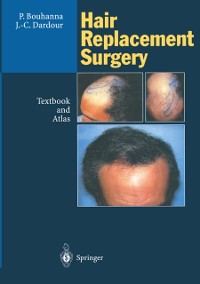 Cover Hair Replacement Surgery