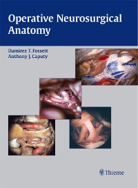 Cover Operative Neurosurgical Anatomy