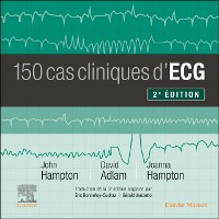 Cover 150 cas cliniques d''ECG