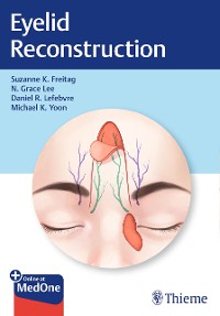 Cover Eyelid Reconstruction