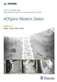 Cover AOSpine Masters Series, Volume 4: Adult Spinal Deformities