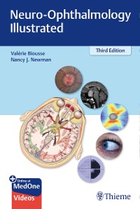 Cover Neuro-Ophthalmology Illustrated