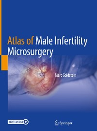 Cover Atlas of Male Infertility Microsurgery