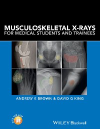 Cover Musculoskeletal X-Rays for Medical Students and Trainees